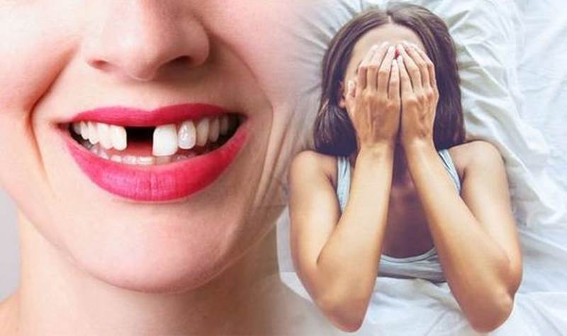 Nằm mơ thấy gãy răng chảy máu là dấu hiệu tốt hay xấu?